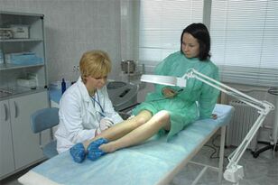 Terapia a laser para veias varicosas nas pernas