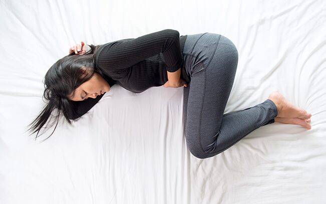 varizes da pélvis em uma mulher