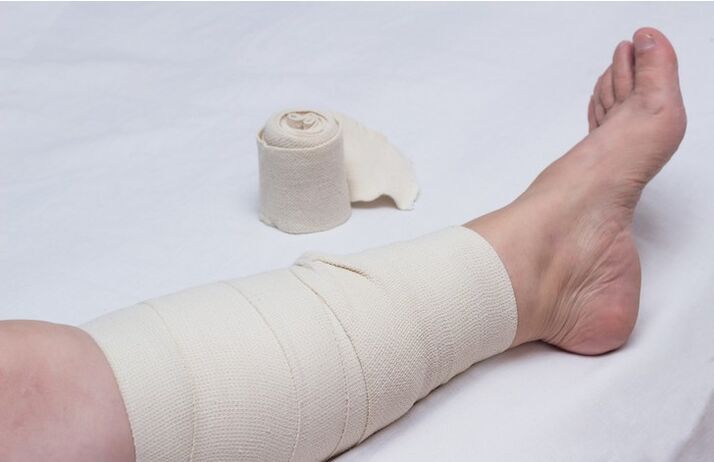 bandagem de compressão na perna para veias varicosas